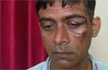 Delhi cabbie assaulted by African nationals for refusing more than 4 passengers